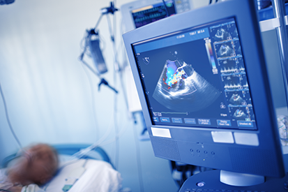 Echocardiography